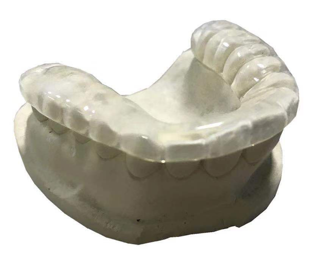 Essix Retainer